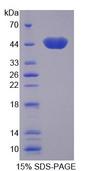 CKMT2 Protein - Recombinant  Creatine Kinase, Mitochondrial 2, Sarcomeric By SDS-PAGE