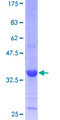 CKS1B / CKS1 Protein - 12.5% SDS-PAGE of human CKS1B stained with Coomassie Blue