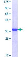 CKS2 Protein - 12.5% SDS-PAGE of human CKS2 stained with Coomassie Blue