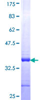 CKS2 Protein - 12.5% SDS-PAGE Stained with Coomassie Blue
