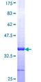CKS2 Protein - 12.5% SDS-PAGE Stained with Coomassie Blue