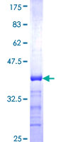 CLASP1 Protein - 12.5% SDS-PAGE Stained with Coomassie Blue.