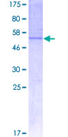 Claudin 20 / CLDN20 Protein - 12.5% SDS-PAGE of human CLDN20 stained with Coomassie Blue