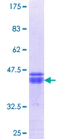 ClC-3 / CLCN3 Protein - 12.5% SDS-PAGE Stained with Coomassie Blue.