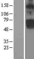 ClC-5 / CLCN5 Protein - Western validation with an anti-DDK antibody * L: Control HEK293 lysate R: Over-expression lysate