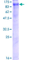 ClC-5 / CLCN5 Protein - 12.5% SDS-PAGE of human CLCN5 stained with Coomassie Blue