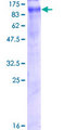 ClC-5 / CLCN5 Protein - 12.5% SDS-PAGE of human CLCN5 stained with Coomassie Blue