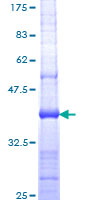 ClC-5 / CLCN5 Protein - 12.5% SDS-PAGE Stained with Coomassie Blue.