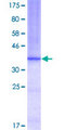 CLC-7 / CLCN7 Protein - 12.5% SDS-PAGE Stained with Coomassie Blue.