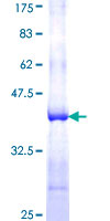 CLCA2 Protein - 12.5% SDS-PAGE Stained with Coomassie Blue.