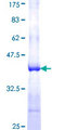 CLCA2 Protein - 12.5% SDS-PAGE Stained with Coomassie Blue.