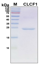 CLCF1 Protein - SDS-PAGE under reducing conditions and visualized by Coomassie blue staining