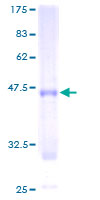 CLCF1 Protein - 12.5% SDS-PAGE of human CLCF1 stained with Coomassie Blue