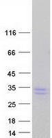 CLCF1 Protein - Purified recombinant protein CLCF1 was analyzed by SDS-PAGE gel and Coomassie Blue Staining