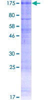 CLCN1 / CLC-1 Protein - 12.5% SDS-PAGE of human CLCN1 stained with Coomassie Blue