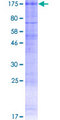 CLCN1 / CLC-1 Protein - 12.5% SDS-PAGE of human CLCN1 stained with Coomassie Blue