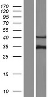CLCN6 Protein - Western validation with an anti-DDK antibody * L: Control HEK293 lysate R: Over-expression lysate
