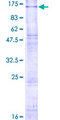 CLCN6 Protein - 12.5% SDS-PAGE of human CLCN6 stained with Coomassie Blue