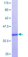 CLCN6 Protein - 12.5% SDS-PAGE Stained with Coomassie Blue.