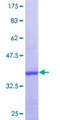 CLCN6 Protein - 12.5% SDS-PAGE Stained with Coomassie Blue.