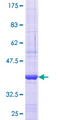 CLCNKB Protein - 12.5% SDS-PAGE Stained with Coomassie Blue.