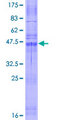 CLDN10 / Claudin 10 Protein - 12.5% SDS-PAGE of human CLDN10 stained with Coomassie Blue
