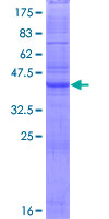 CLDN11 / Claudin 11 Protein - 12.5% SDS-PAGE of human CLDN11 stained with Coomassie Blue