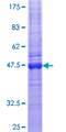 CLDN12 / Claudin 12 Protein - 12.5% SDS-PAGE of human CLDN12 stained with Coomassie Blue