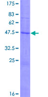 CLDN14 / Claudin 14 Protein - 12.5% SDS-PAGE of human CLDN14 stained with Coomassie Blue