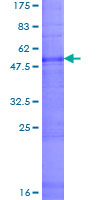 CLDN16 / Claudin 16 Protein - 12.5% SDS-PAGE of human CLDN16 stained with Coomassie Blue
