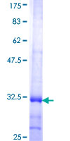 CLDN16 / Claudin 16 Protein - 12.5% SDS-PAGE Stained with Coomassie Blue.