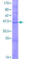 CLDN17 / Claudin 17 Protein - 12.5% SDS-PAGE of human CLDN17 stained with Coomassie Blue