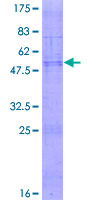 CLDN18 / Claudin 18 Protein - 12.5% SDS-PAGE of human CLDN18 stained with Coomassie Blue