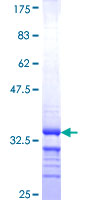 CLDN18 / Claudin 18 Protein - 12.5% SDS-PAGE Stained with Coomassie Blue.