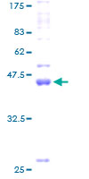 CLDN19 / Claudin 19 Protein - 12.5% SDS-PAGE of human CLDN19 stained with Coomassie Blue