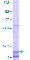 CLDN19 / Claudin 19 Protein - 12.5% SDS-PAGE Stained with Coomassie Blue.