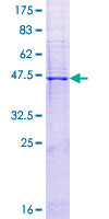 CLDN2 / Claudin 2 Protein - 12.5% SDS-PAGE of human CLDN2 stained with Coomassie Blue