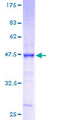 CLDN3 / Claudin 3 Protein - 12.5% SDS-PAGE of human CLDN3 stained with Coomassie Blue