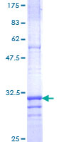CLDN4 / Claudin 4 Protein - 12.5% SDS-PAGE Stained with Coomassie Blue.
