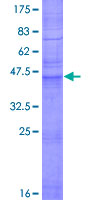 CLDN5 / Claudin 5 Protein - 12.5% SDS-PAGE of human CLDN5 stained with Coomassie Blue