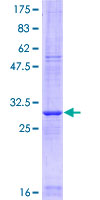 CLDN5 / Claudin 5 Protein - 12.5% SDS-PAGE Stained with Coomassie Blue.