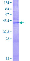 CLDN7 / Claudin 7 Protein - 12.5% SDS-PAGE of human CLDN7 stained with Coomassie Blue