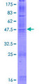CLDN8 / Claudin 8 Protein - 12.5% SDS-PAGE of human CLDN8 stained with Coomassie Blue