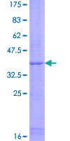 CLDND2 Protein - 12.5% SDS-PAGE of human MGC33839 stained with Coomassie Blue