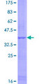 CLDND2 Protein - 12.5% SDS-PAGE of human MGC33839 stained with Coomassie Blue