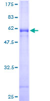 CLEC10A / CD301 Protein - 12.5% SDS-PAGE of human CLEC10A stained with Coomassie Blue