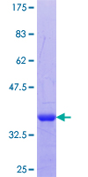 CLEC10A / CD301 Protein - 12.5% SDS-PAGE Stained with Coomassie Blue.