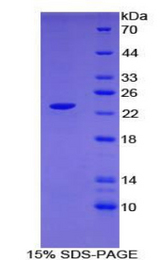 CLEC10A / CD301 Protein - Recombinant C-Type Lectin Domain Family 10, Member A By SDS-PAGE