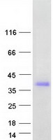 CLEC10A / CD301 Protein - Purified recombinant protein CLEC10A was analyzed by SDS-PAGE gel and Coomassie Blue Staining