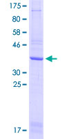 CLEC12A / CD371 Protein - 12.5% SDS-PAGE Stained with Coomassie Blue.